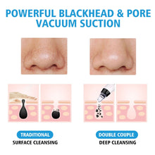 Blackhead Remover Face Nose T Zone Clean Pore Acne Pimple Removal New HQ